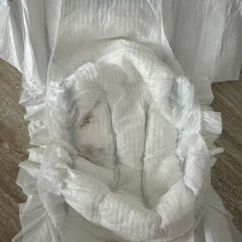 Molfix Bebek Bezinde Sert Koyu Renkli Yabancı Madde Ve Sürekli Sızdırma Sorunu
