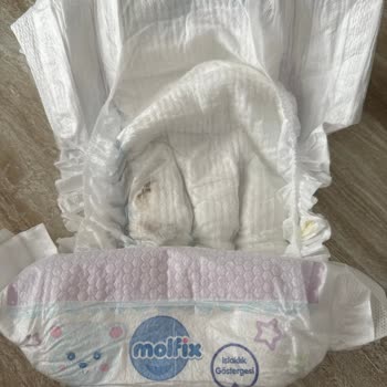 Molfix Bebek Bezinde Sert Koyu Renkli Yabancı Madde Ve Sürekli Sızdırma Sorunu