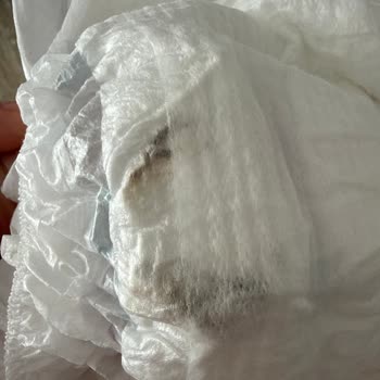 Molfix Bebek Bezinde Sert Koyu Renkli Yabancı Madde Ve Sürekli Sızdırma Sorunu