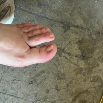 Sporset Mağazasının New Balance Ayakkabısında Aşırı Sıkma Sorunu Ve İade Reddi