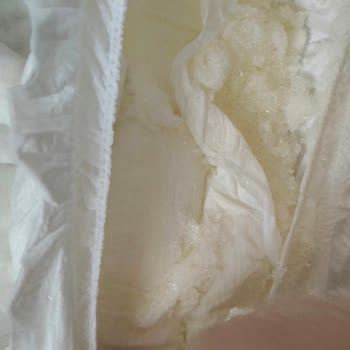 Sleepy Natural Külot Bezlerde Açılma Ve Kristallenme Sorunu