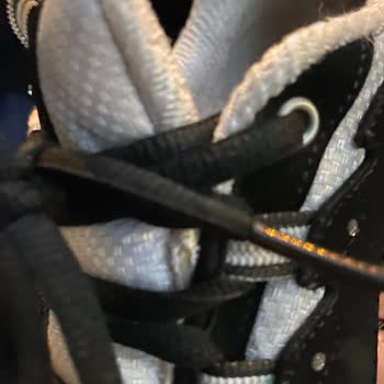 Skechers D’Lites Ayakkabısının İç Topuk Deformasyonu Üretim Hatası Olarak Değerlendirilmemesi