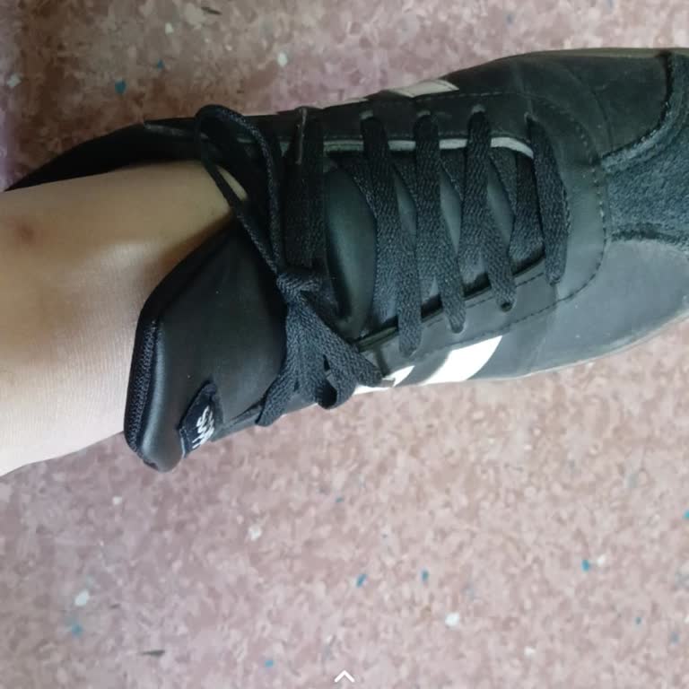 Ayakkabı Dilinin Uzunluğu Dengeyi Bozuyor Değişim Talebi