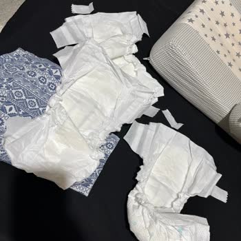 Cırtı Sorunu Nedeniyle Kullanılamayan Bebek Bezi Ve Cevapsız Müşteri Desteği