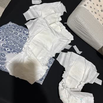 Cırtı Sorunu Nedeniyle Kullanılamayan Bebek Bezi Ve Cevapsız Müşteri Desteği
