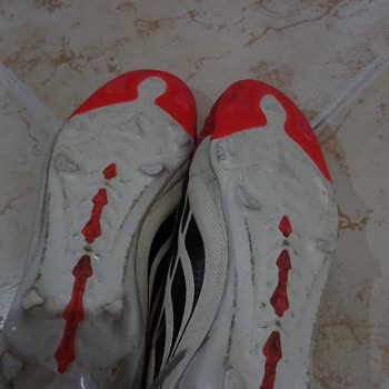 Adidas Predator Kramponun Dişleri Kısa Sürede Kırıldı, Garanti Reddi