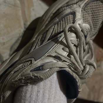 Reebok Ayakkabısının Kısa Sürede Dikiş Patlaması Ve Ücret İadesi Talebi