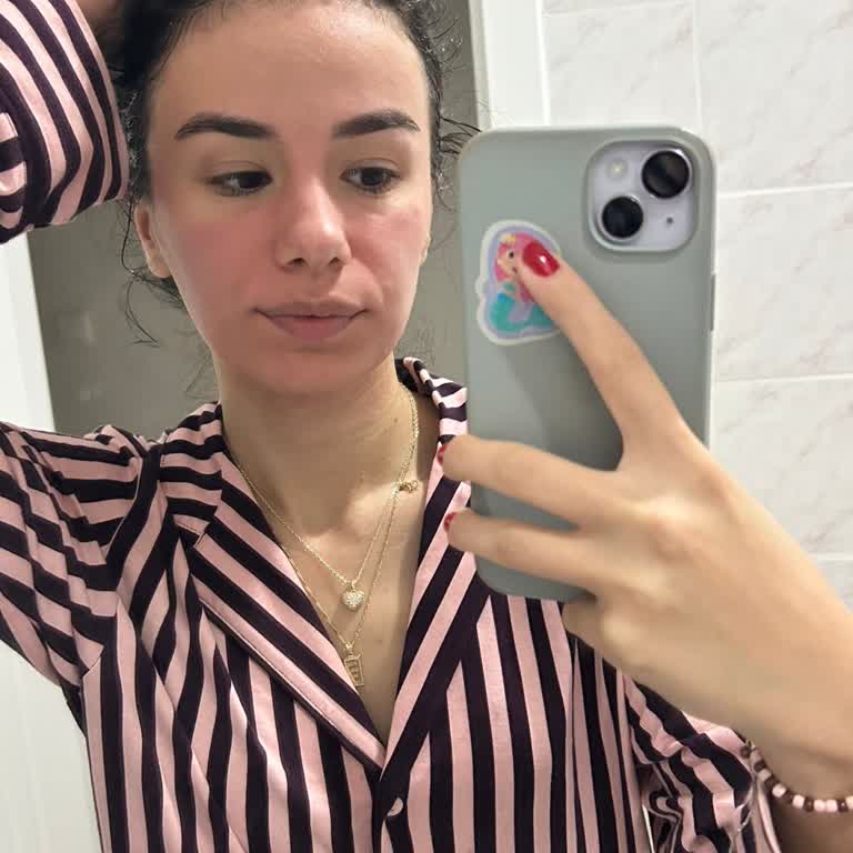 Garnier Salicylic Serum Maskesi Alerjik Reaksiyon Ve Şiddetli Kaşıntı