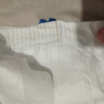 Grossa Market'ten Alınan Molfix Bebek Bezinde Çizgili Ürün Ve Hijyen Sorunu