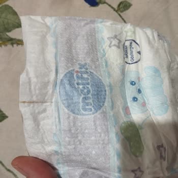 Grossa Market'ten Alınan Molfix Bebek Bezinde Çizgili Ürün Ve Hijyen Sorunu