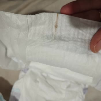 Grossa Market'ten Alınan Molfix Bebek Bezinde Çizgili Ürün Ve Hijyen Sorunu