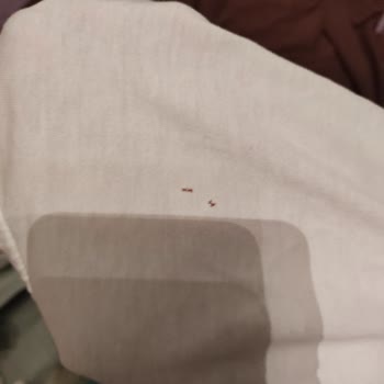 Çamaşır Makinesinin Kıyafetleri Delmesi Ve Yetkili Servisin Çözüm Bulamaması