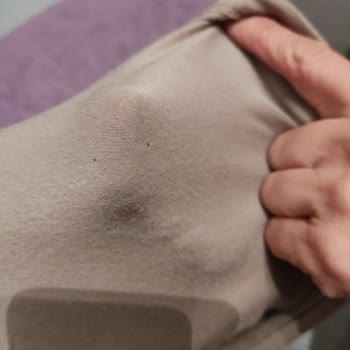 Çamaşır Makinesinin Kıyafetleri Delmesi Ve Yetkili Servisin Çözüm Bulamaması