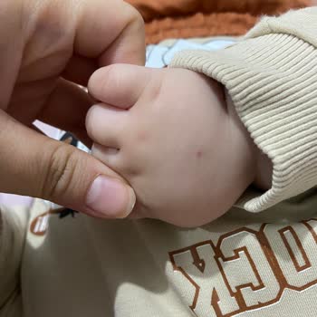 6 Aylık Bebeğimde Aşırı İğne Girişimleri Ve Anestezi Sorunları