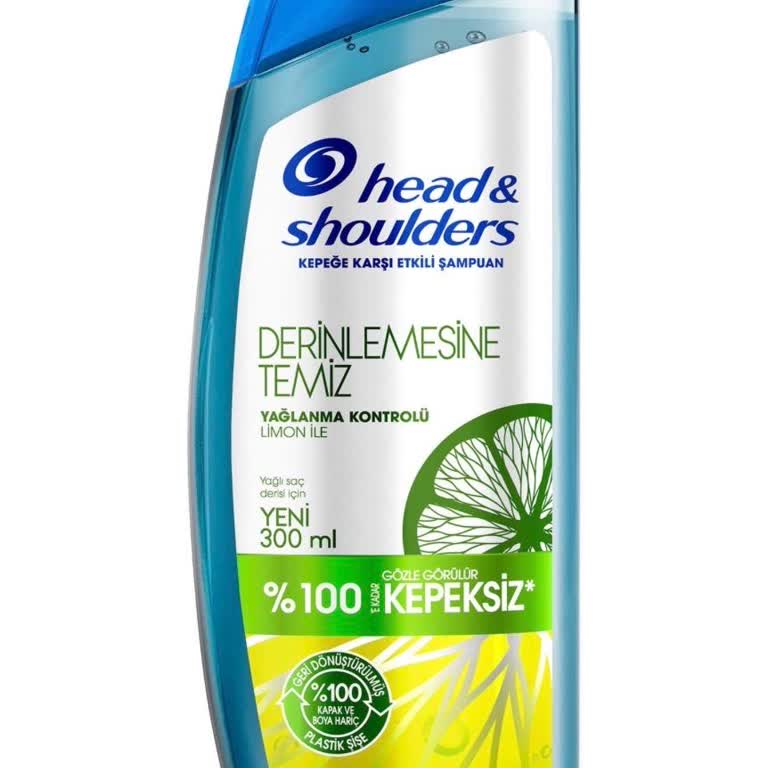 Head&Shoulders Şampuanı Saç Derisinde Şiddetli Kaşıntı Ve Tahriş Yaratıyor