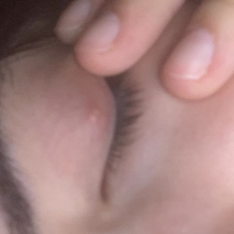 Flormar Kırmızı Maskara Kullanımından Göz Yaraları Ve Sağlık Sorunu