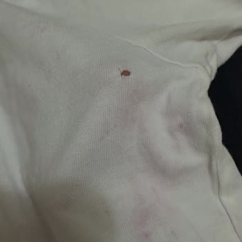 Tedarikçi Ve Platformun Lekeli Tişört İadesini Reddetmesi Ve Çözüm Sunamaması