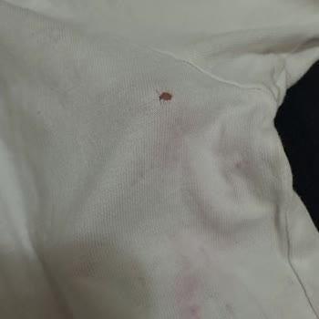 Tedarikçi Ve Platformun Lekeli Tişört İadesini Reddetmesi Ve Çözüm Sunamaması