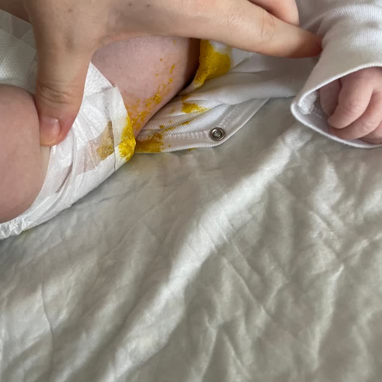Molfix Bebek Bezlerinde Sürekli Sızdırma Ve Taşma Sorunu