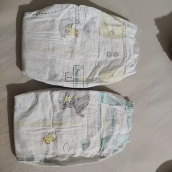 Prima Premium Care 1 Numaralı Bebek Bezinde Kalite Düşüşü Ve Orijinallik Şüphesi