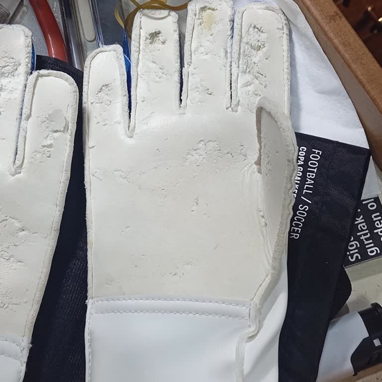 Adidas Online Mağazadan Defolu Kaleci Eldiveni Ve Değişim Reddi