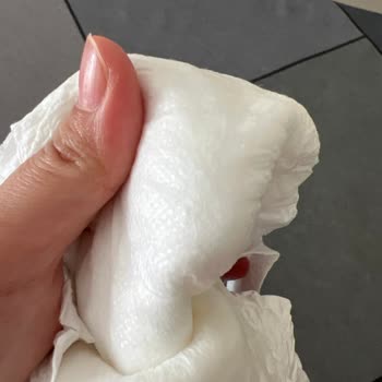 Sleepy Natural Bebek Bezinde Hava Almayan Pütürlü Doku Nedeniyle Şiddetli Pişik Ve İade Talebi