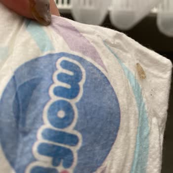 Molfix Bebek Bezinde Kurt Görülmesi Hijyen Ve Güveni Sarsıyor