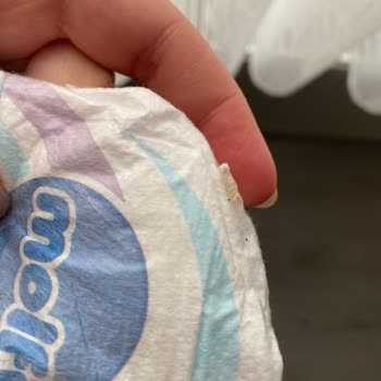 Molfix Bebek Bezinde Kurt Görülmesi Hijyen Ve Güveni Sarsıyor