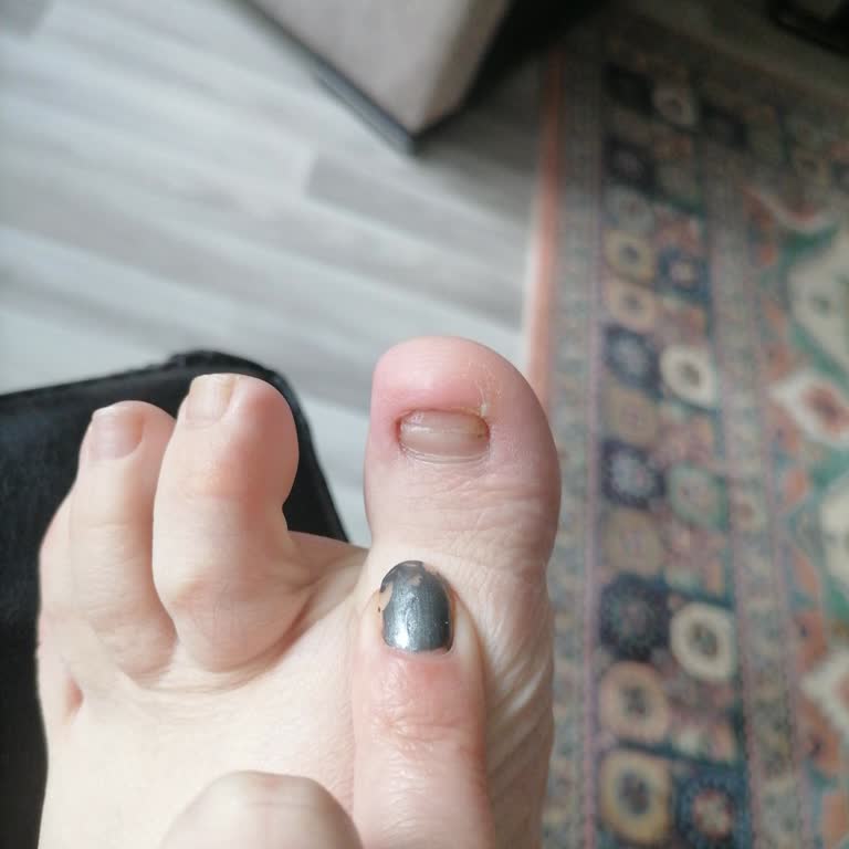 Çorum Hitit Üniversitesi Hastanesinde Basit Tırnak Çekimi Reddedilmesi Ve Kaba Hekim Tutumu