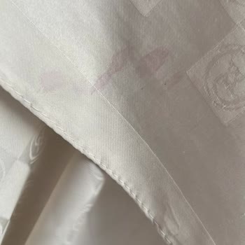 İç Gösteren Ve Renk Aktaran Tunikten Sağlık Riski, Tam İade Talebi