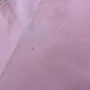 Elina.dres Kiraladığı Abiyede Yırtık ve Saç Teli Bulunması Nedeniyle Tam İade Talebi