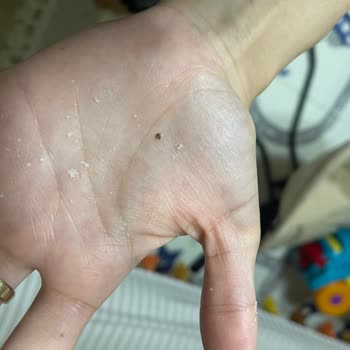 Hero Baby Sütlü 8 Tahıllı Mama’da Yabancı Böcek Benzeri Parçacıklar Ve Sağlık Riski