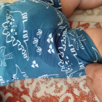 Sleepy Natural Bebek Bezinde Tekrarlayan Sızdırma Sorunu Ve Çözüm Eksikliği