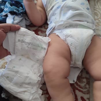 Sleepy Natural Bebek Bezinde Tekrarlayan Sızdırma Sorunu Ve Çözüm Eksikliği