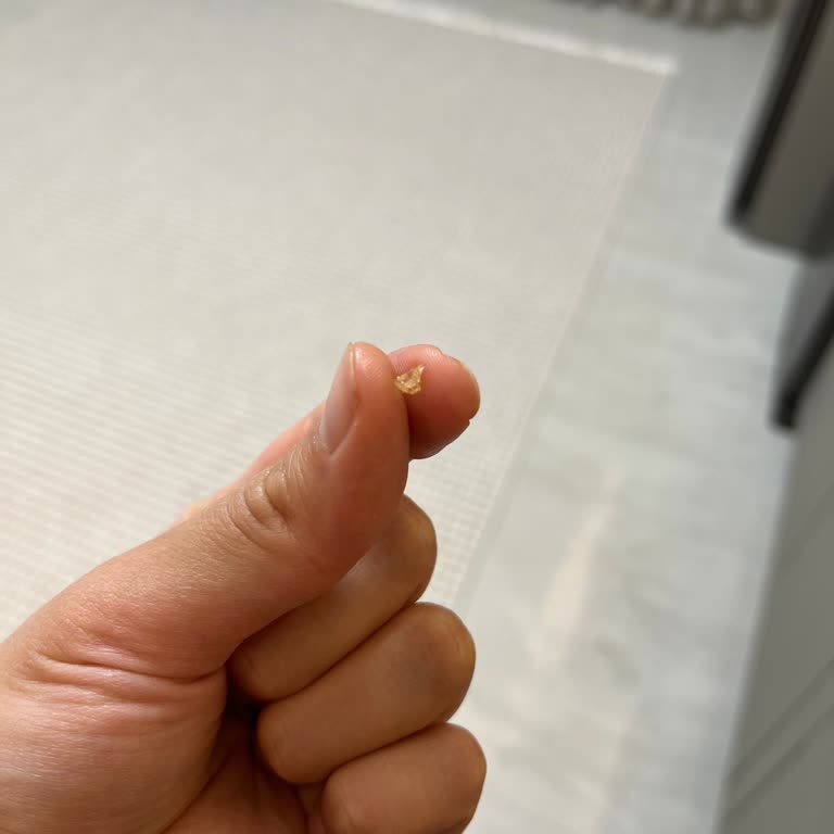 A101 Wawa Ton Balığı Konservesinde Cam Parçası Bulunması Dil Kesilmesine Neden Oldu