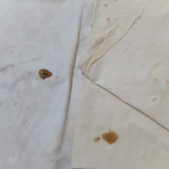 Nimet Yufkasında Kahverengi Lekeler Ve Kötü Koku: Sağlık Riski