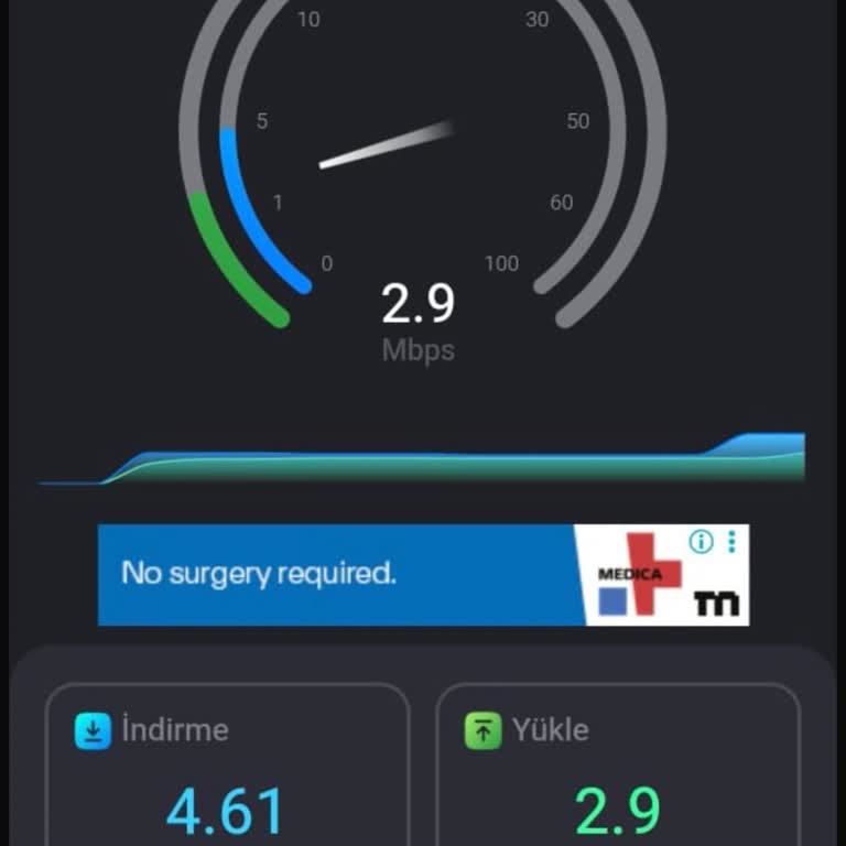 Kablo Net 1000 Mbps Fiber Hızının Sürekli Düşmesi Ve Destek Yanıtı Yok