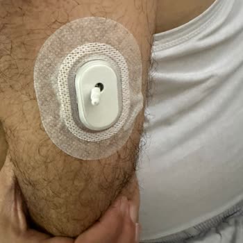 Sibionics GS1 Sensörünün Arızası Ve Hızlı Ücretsiz Değişim Talebi