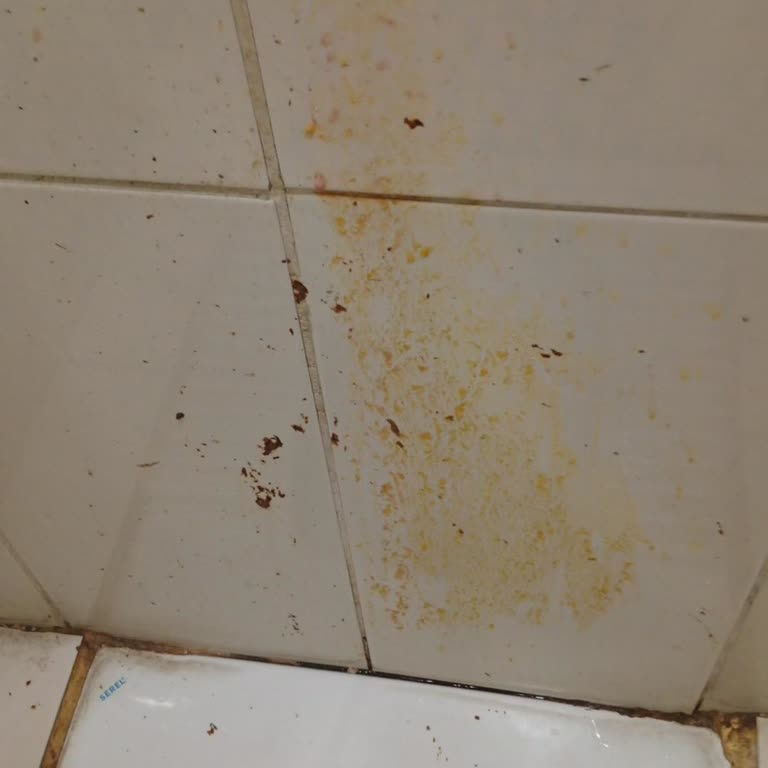 Ankara Eğitim Araştırma Hastanesinde Kirli Tuvaletler Ve Aşırı Fahiş Kantin Fiyatları