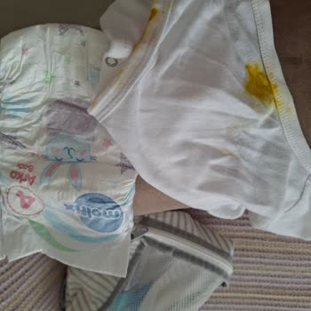 Molfix Klasik 4 Numaralı Bebek Bezinde Sürekli Sızdırma Sorunu Ve Tam İade Talebi