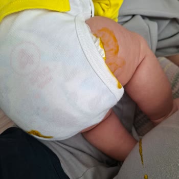 Molfix Klasik 4 Numaralı Bebek Bezinde Sürekli Sızdırma Sorunu Ve Tam İade Talebi