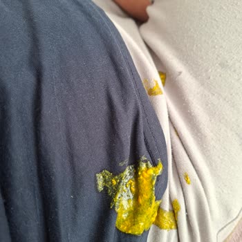 Molfix Klasik 4 Numaralı Bebek Bezinde Sürekli Sızdırma Sorunu Ve Tam İade Talebi