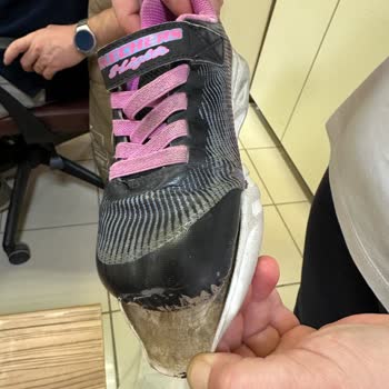 Skechers Çocuk Ayakkabısındaki Erken Yıpranma Ve Mağaza Çalışanlarının İlgisiz Tutumu