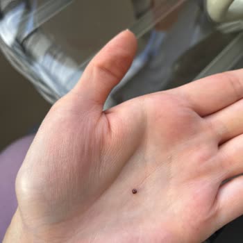 Yayla Gıda Pirinç Patlağında Siyah Yabancı Madde Bulunması