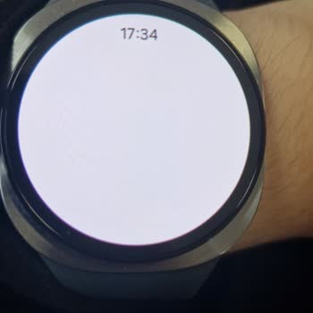 Samsung Galaxy Watch 8 Ekranındaki Kırmızı Piksel Ve Trendyol İade Reddi