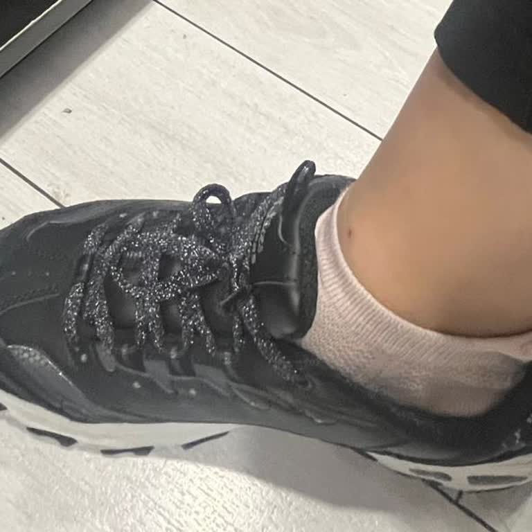 Skechers D’Lites Ayakkabısının Hızlı Gevşemesi Ve Değişim Talebi