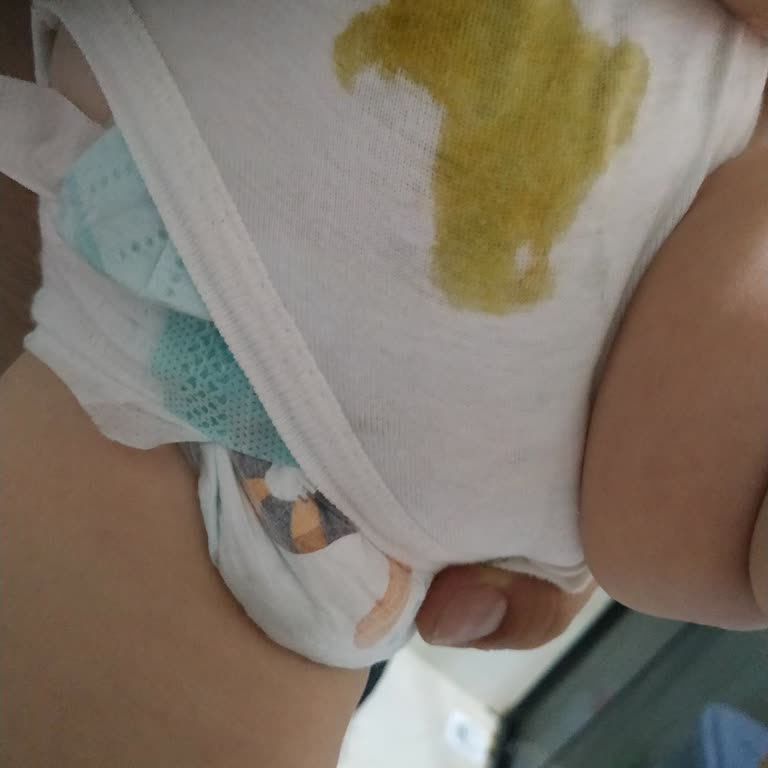 Pampers Prima Aktif Bebek Bezinde Sızdırma Sorunu Ve Ücret İadesi Talebi