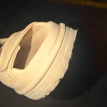 Ugg Sandaletinin Tabanı Eridi Ve Mağaza İnceleme Reddi