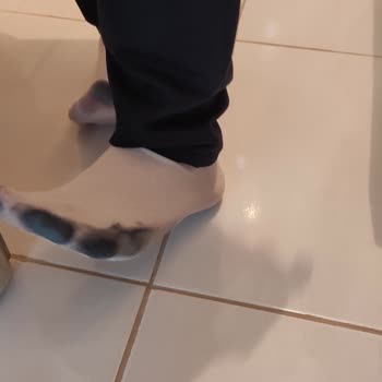 Puma Ayakkabısının Renk Sızması Çorap Ve Ayağımda Kalıcı Morarma Oluşturdu