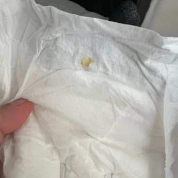Sleepy Natural Bebek Bezinde Hijyen Sorunu Ve Çözüm İsteği